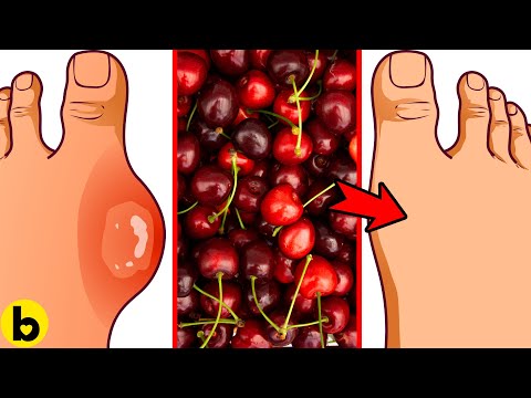 7 Surprising Health Perks of Eating Cherries