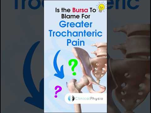 Understanding Greater Trochanteric Pain Syndrome post thumbnail image