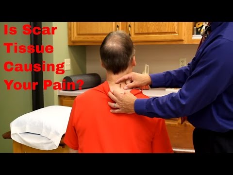 Understanding Scar Tissue in Your Neck and Back