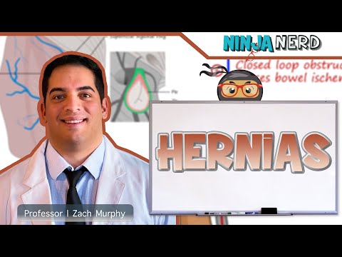 Understanding Hernias: Types, Symptoms, and Treatments