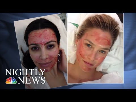 Understanding HIV Risks: Are Vampire Facials Safe? post thumbnail image