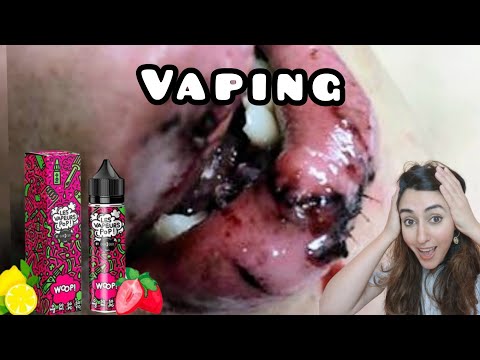 Vaping and Your Dental Health: 7 FAQs on Stains and Decay