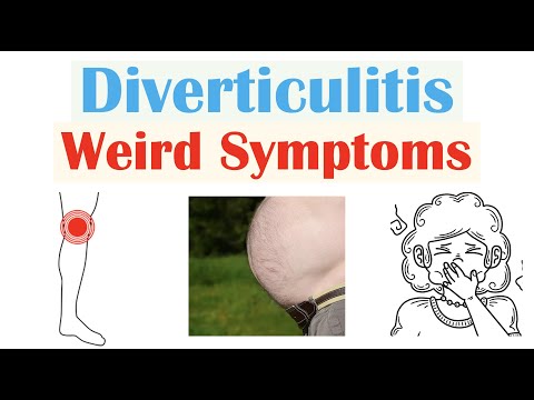 Left Side Lower Abdomen Pain: Signs of Diverticulitis