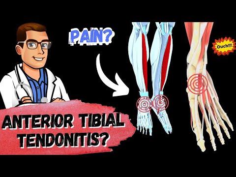 What to Know About Tibialis Anterior Tendonitis Symptoms and Care