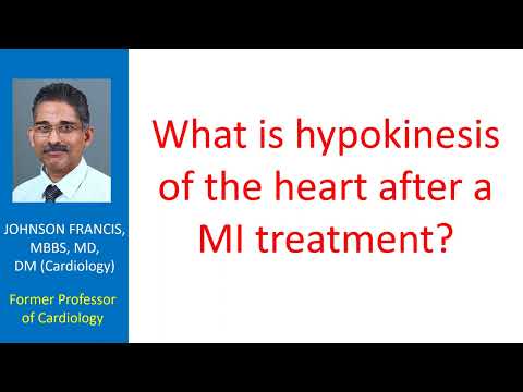 Understanding the Causes and Effects of Hypokinesia