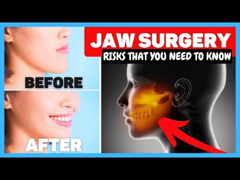 Understanding Jawline Surgery: Costs, Procedures, and Recovery