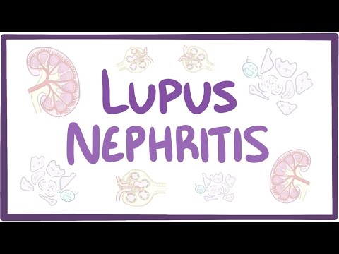 Understanding Lupus Nephritis: Symptoms and Treatment Options