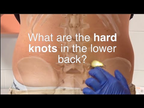 Understanding Back Mice: Symptoms and Effective Treatments