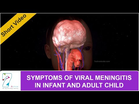 Recognizing Meningitis Symptoms in Children and Adults