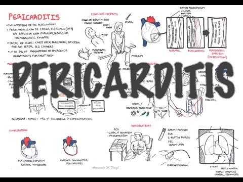 Understanding Pericarditis: Symptoms and Treatment Explained
