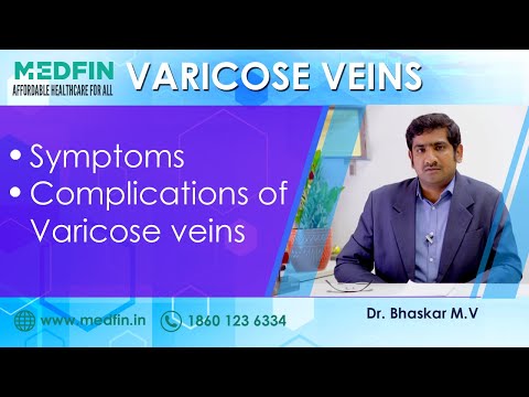 Understanding Varicose Veins: Risks and Warning Signs