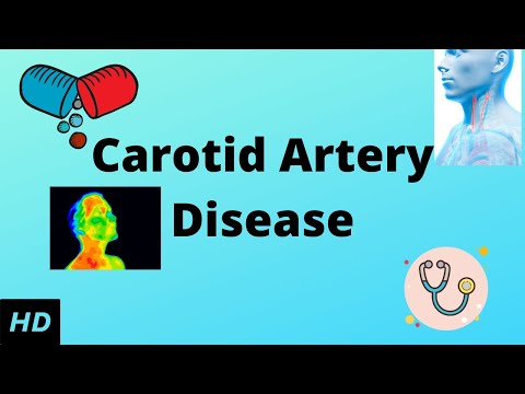 Understanding the External Carotid Artery's Role in Health