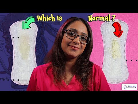 Understanding Vaginal Discharge: Causes and Solutions post thumbnail image