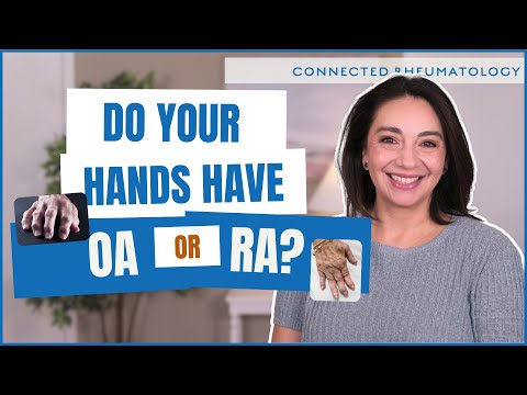 5 Reasons Your Hand Hurts and What It Means