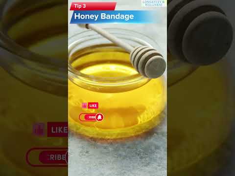 Essential Home Remedies for Treating Burns Safely