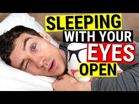 Understanding Nocturnal Lagophthalmos: Sleeping with Eyes Open post thumbnail image