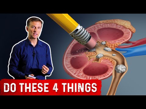 Understanding High Oxalate Foods and Kidney Stone Risk post thumbnail image