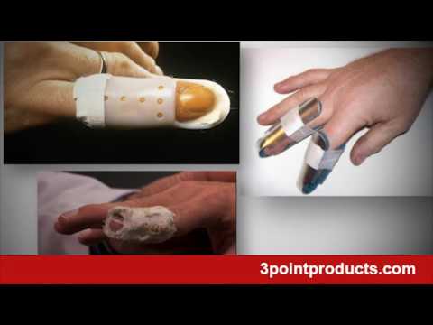 8 Essential Finger Splints for Effective Recovery and Care post thumbnail image