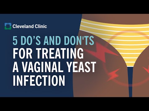 10 Essential Tips to Prevent Yeast Infections Effectively