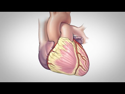 Understanding Triple Bypass Surgery: Journey Through Purpose, Risks, and Recovery post thumbnail image