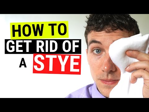 Essential Tips for Preventing Styes and Maintaining Eye Health