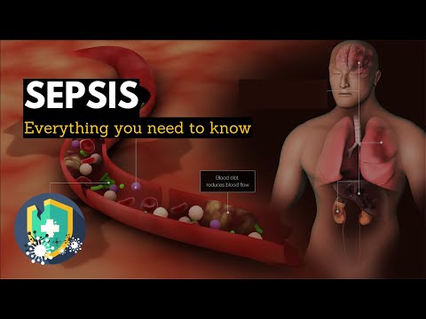 Understanding Blood Poisoning: Symptoms, Causes, and Care