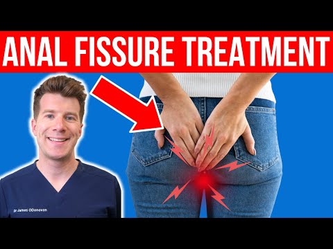 9 Foods to Try for Fast Relief from Fissures