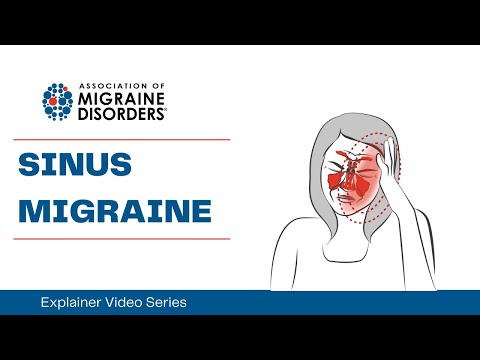 Understanding Sinus Headaches: Symptoms and Effective Treatments