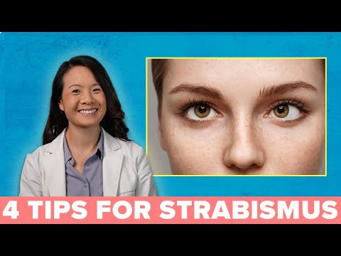 Understanding Exotropia: Signs, Care, and Insights