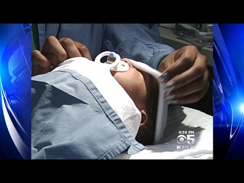 Circumcision: Weighing the Benefits and Risks for Your Health