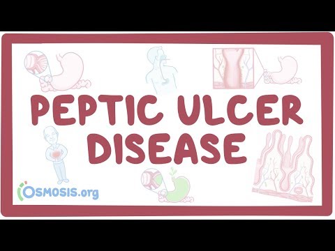 Understanding Ulcers: Causes, Symptoms, and Risks Explained