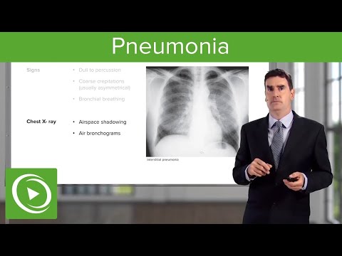 Understanding Bronconeumonía: Causes, Symptoms, and Diagnosis