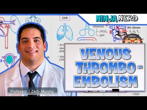 Understanding Thromboembolism: Symptoms, Diagnosis, and Care post thumbnail image