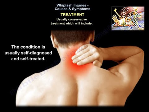 Whiplash Injury: Understanding Causes, Symptoms, and Care
