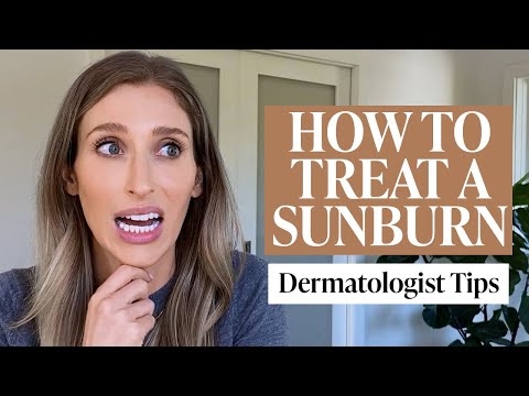 Sunburn Recovery: How Soon Can Your Skin Heal?