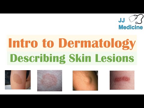 Skin Lesions Explained: Causes, Diagnosis, and Treatment Options