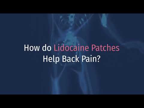 Lidocaine Patches for Back Pain: Benefits and Effectiveness