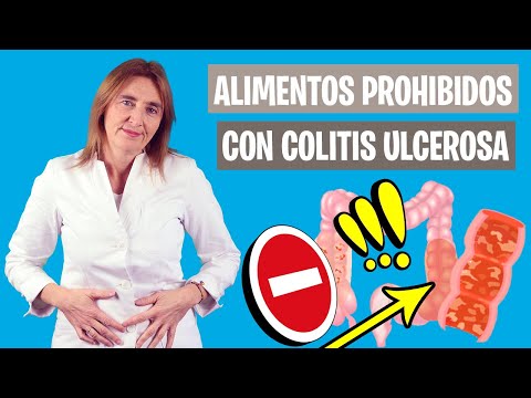 Biológicos para la colitis ulcerosa: cuáles elegir y evitar