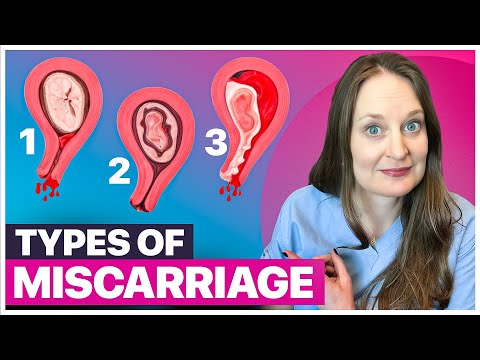 Understanding Spontaneous Abortion: Symptoms, Causes, and Support post thumbnail image