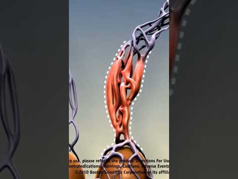 Essential Insights on Varicocele Surgery: Care and Recovery