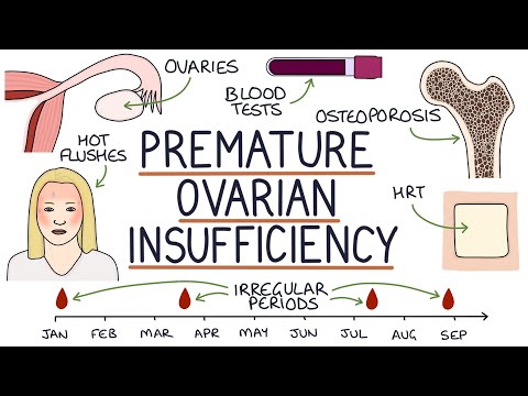 Understanding Primary Ovarian Insufficiency: Symptoms and Care