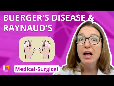 Understanding Buerger's Disease: Causes, Symptoms, and Care