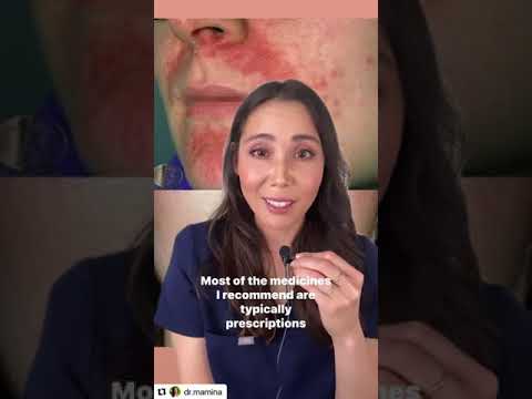 Effective Over-the-Counter Treatments for Perioral Dermatitis