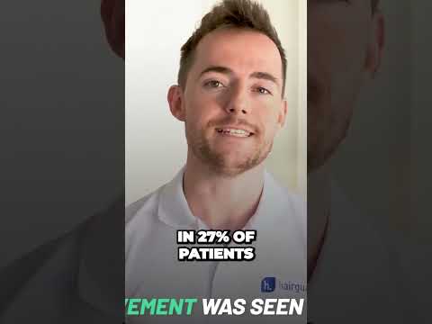 New Hope for Hair Regrowth: Oral Minoxidil Breakthrough