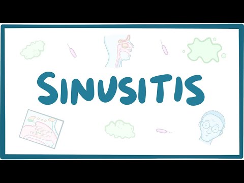 Sinusitis Uncovered: Signs, Risks, and Treatment Options