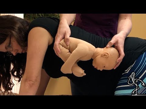 Understanding the Implications of a Sunny Side Up Baby