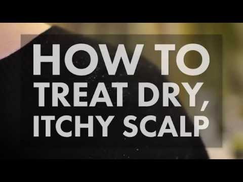 Soothe Your Dry Scalp with These Simple Remedies