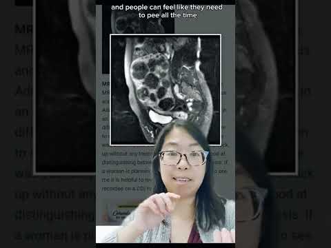 Recognizing Cancer Symptoms After Hysterectomy: What to Watch For