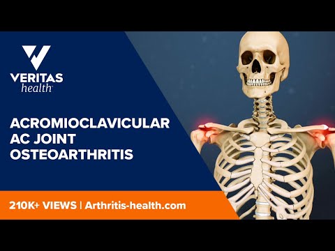 Understanding AC Joint Arthritis: Symptoms and Treatment Options