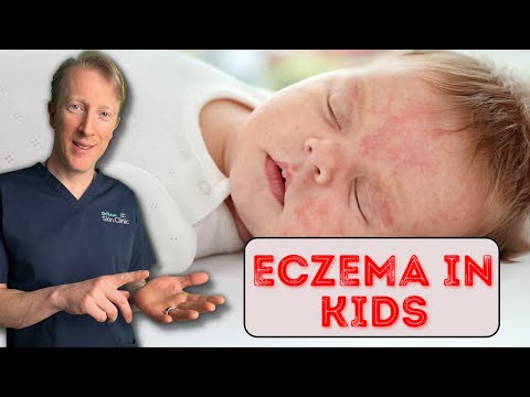 Understanding Baby Eczema and Acne: Key Differences Explained